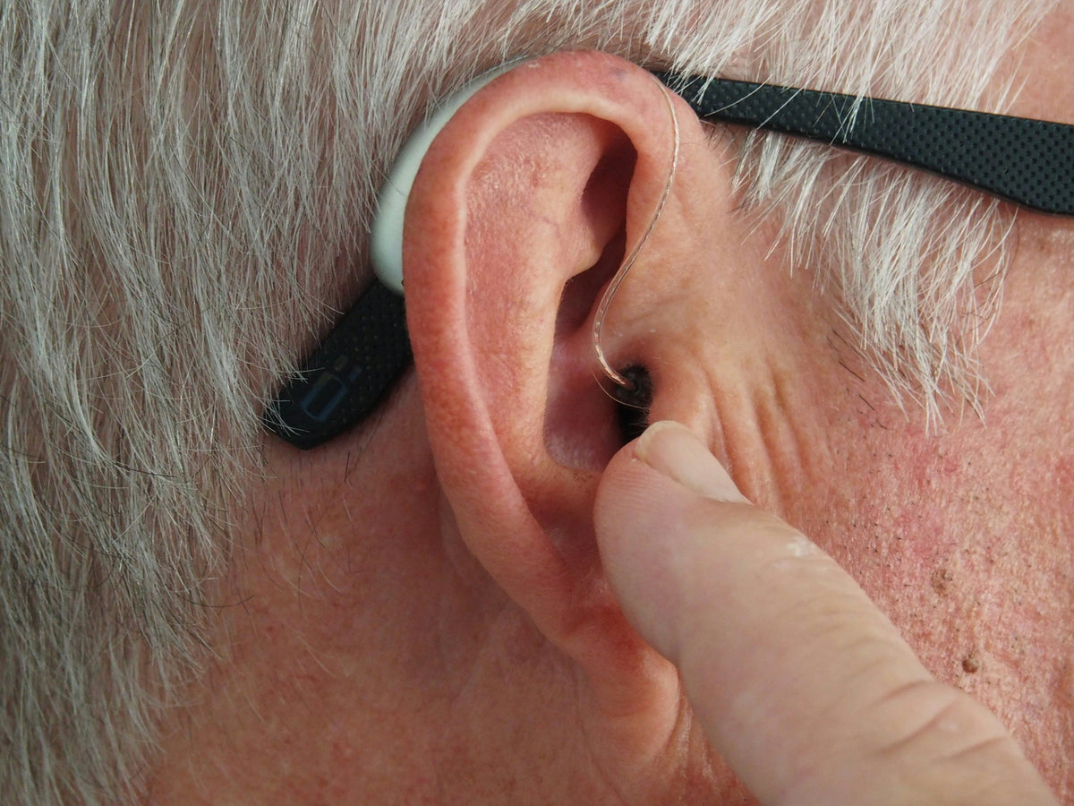 Cerume o cera del oído ¿Puede el exceso de cerumen causar pérdidas de audición?